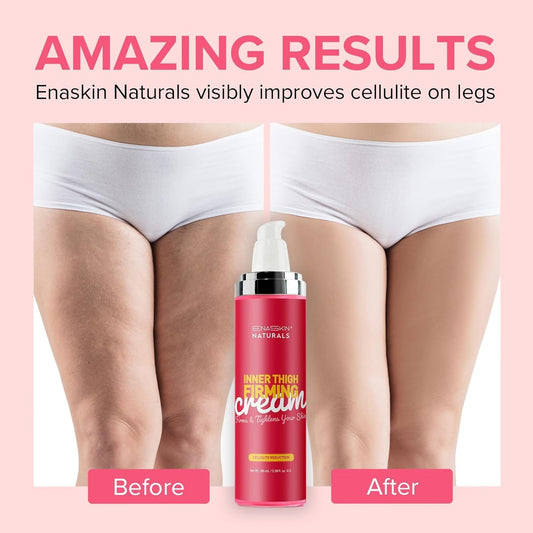 Cellulite Cream for Inner Thighs - Skin Tightening Cream for Legs & Stomach with Collagen Peptides, Hyaluronic Acid & Honey - Lifting Firming Body Lotion for Women, 100 ML